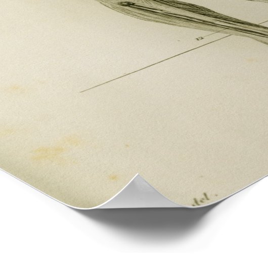 hypertensie van het lymfatisch systeem poster (Hoek)