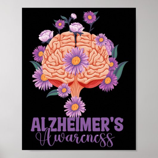 Ik Zal Het Voor Jou Onthouden Brain Heimerheimer i Poster (Voorkant)