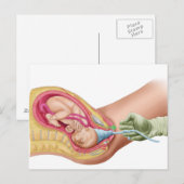 Illustratie met de resultaten van foetus 1 briefkaart (Voorkant / Achterkant)