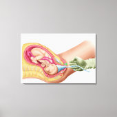 Illustratie met de resultaten van foetus 1 canvas afdruk (Voorkant)