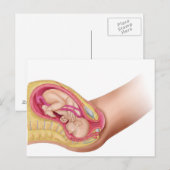 Illustratie met de resultaten van foetus 2 briefkaart (Voorkant / Achterkant)