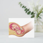 Illustratie met de resultaten van foetus 2 briefkaart (Staand voorkant)