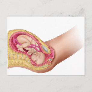 Illustratie met de resultaten van foetus 2 briefkaart