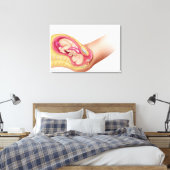 Illustratie met de resultaten van foetus 2 canvas afdruk (Insitu (Slaapkamer))