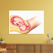 Illustratie met de resultaten van foetus 2 canvas afdruk (Insitu (Woonkamer))
