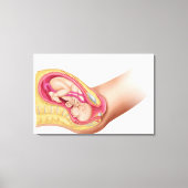 Illustratie met de resultaten van foetus 2 canvas afdruk (Voorkant)