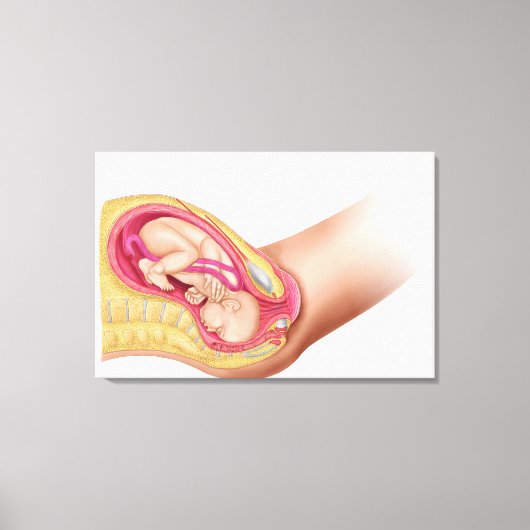 Illustratie met de resultaten van foetus 2 canvas afdruk (Voorkant)