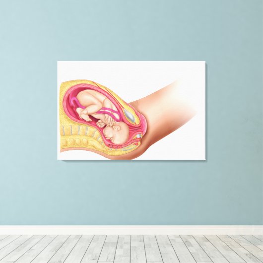 Illustratie met de resultaten van foetus 2 canvas afdruk (Insitu (Houten vloer))
