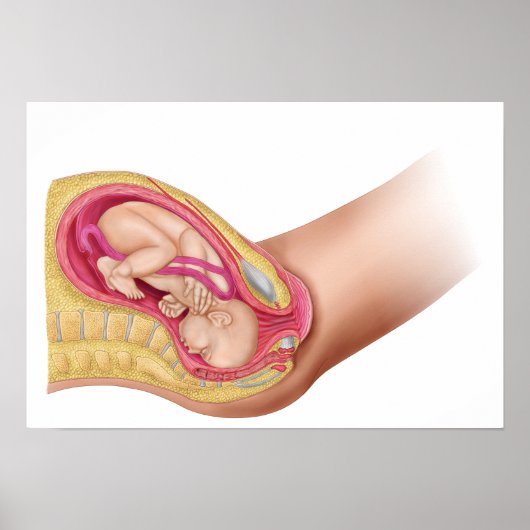 Illustratie met de resultaten van foetus 2 poster (Voorkant)