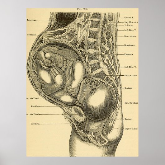 Illustratie Obstetrie Poster (Voorkant)