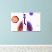 Illustratie van een astmaaanval van stuifmeel canvas afdruk (Insitu (Houten vloer))