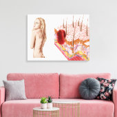 Illustratie van een atypische groei van de huid canvas afdruk (Insitu (Woonkamer))