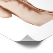 Illustratie van een atypische groei van de huid poster (Hoek)