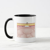 Illustratie van een hernia mok (Links)