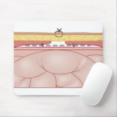 Illustratie van een hernia muismat (Met muis)