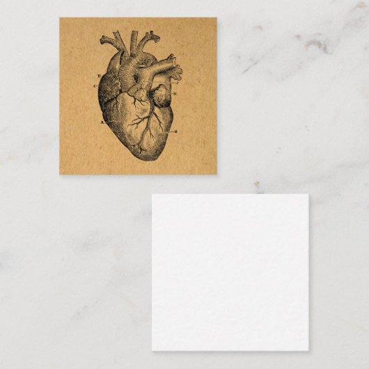 illustratie van hartdiagram illustratie kunst informatiekaartje (Voorkant / Achterkant)