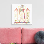 Illustratie van het Tooth Decay Canvas Afdruk (Insitu (Woonkamer))