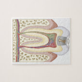 Illustratie van het Tooth Decay Legpuzzel (Horizontaal)