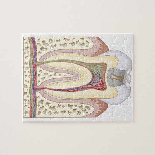 Illustratie van het Tooth Decay Legpuzzel (Horizontaal)