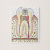 Illustratie van het Tooth Decay Legpuzzel (Verticaal)