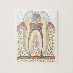 Illustratie van het Tooth Decay Legpuzzel