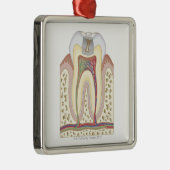 Illustratie van het Tooth Decay Metalen Ornament (Rechts)