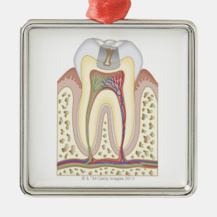 Illustratie van het Tooth Decay Metalen Ornament