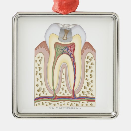 Illustratie van het Tooth Decay Metalen Ornament (Voorkant)