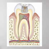 Illustratie van het Tooth Decay Poster (Voorkant)