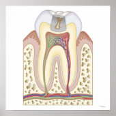 Illustratie van het Tooth Decay Poster (Voorkant)