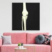 Illustratie van knie bot, recht canvas afdruk (Insitu (Woonkamer))