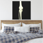 Illustratie van knie bot, recht canvas afdruk (Insitu (Slaapkamer))