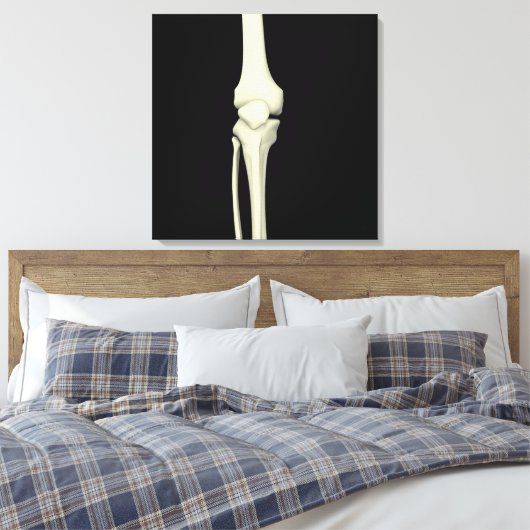 Illustratie van knie bot, recht canvas afdruk (Insitu (Slaapkamer))