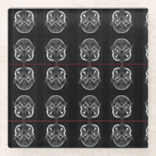 IM in uw hoofd röntgenfoto MRI scan medisch Glazen Onderzetter