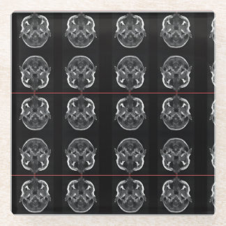IM in uw hoofd röntgenfoto MRI scan medisch Glazen Onderzetter