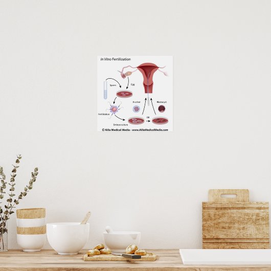 In-vitrofertilisatie (IVF) procedure geëtiketteerd Poster (Keuken)