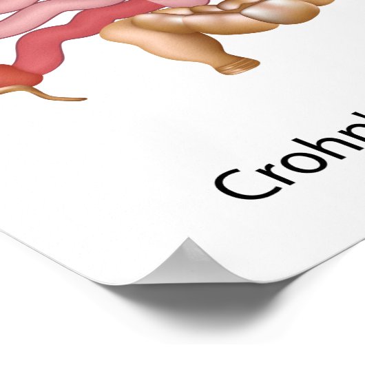 inflammatoire darmziekte ( ibd ) poster (Hoek)