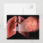 Inflammen van de luchtwegen tijdens een astmaaanva briefkaart (Voorkant / Achterkant)