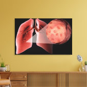 Inflammen van de luchtwegen tijdens een astmaaanva canvas afdruk (Insitu (Woonkamer))