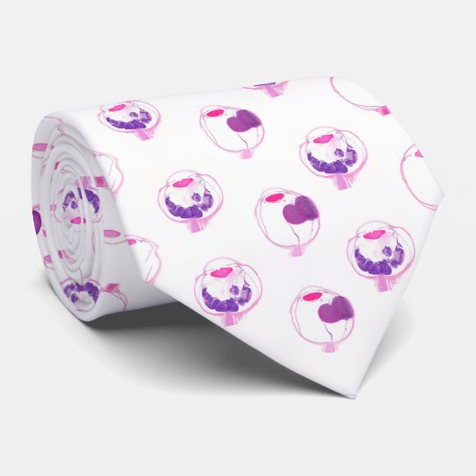 Intraoculaire tumor stropdas (Opgerold)