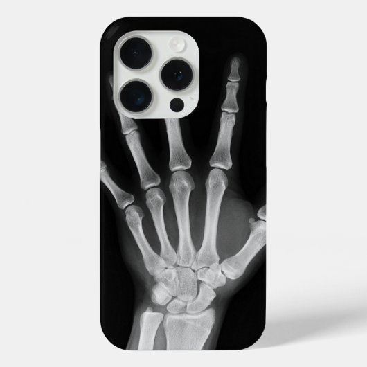 iPhone 15 pro hoesje met skelet ontwerp (Achterkant)