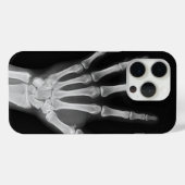 iPhone 15 pro hoesje met skelet ontwerp (Achterkant (horizontaal))