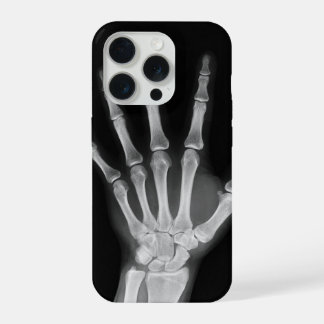 iPhone 15 pro hoesje met skelet ontwerp