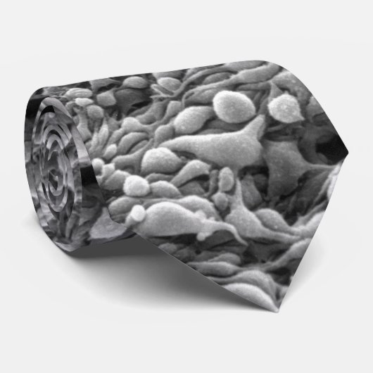 Iris melanoom (leven in aandoening) stropdas (Opgerold)