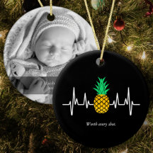IVF Baby ananas elke foto waard