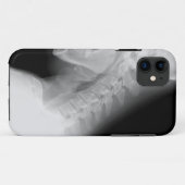 Jaw en Spine X Ray IPhone-draagtas Case-Mate iPhone Case (Achterkant (horizontaal))