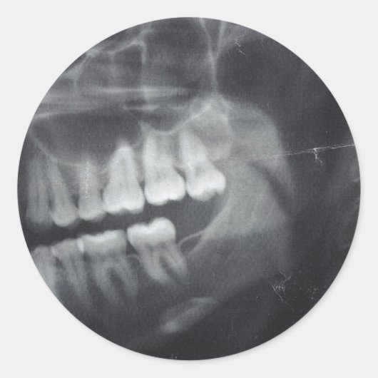 Jaw Stickers (Voorkant)