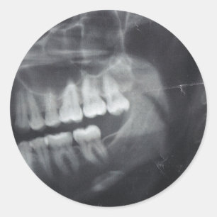 Jaw Stickers