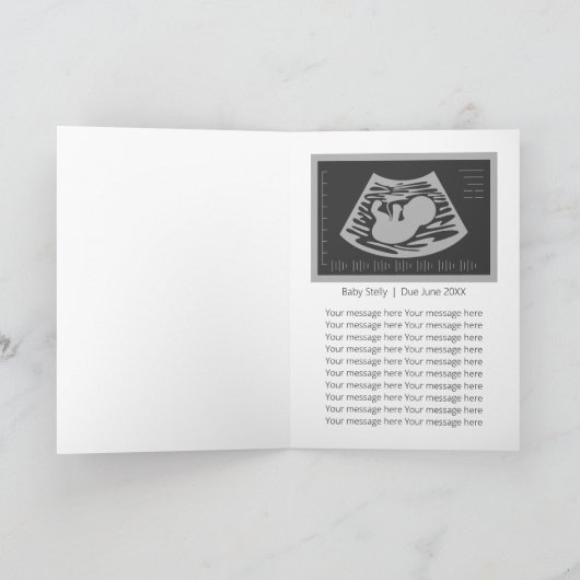 Je bent opgenomen in Poop Squad - Zwangerschap Kaart (Binnen)