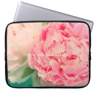 Je bent prachtig laptop sleeve
